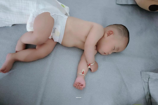 汉中宝宝上火有眼屎